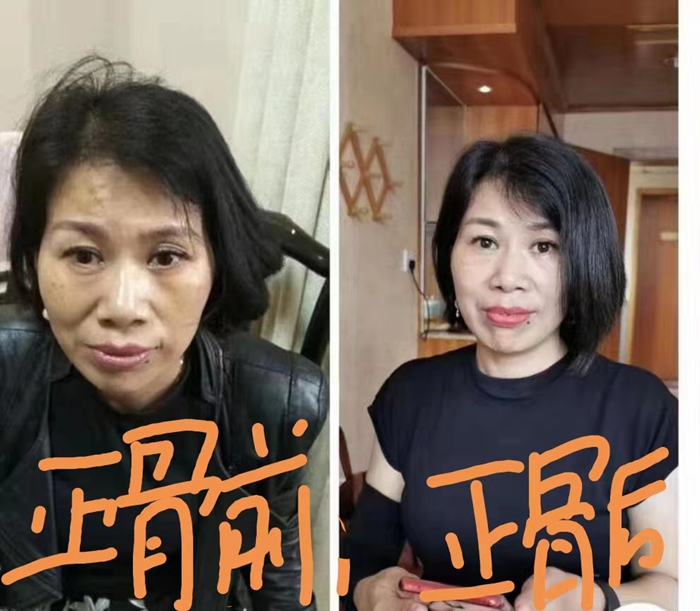 高級(jí)反射蜂療專家范景良