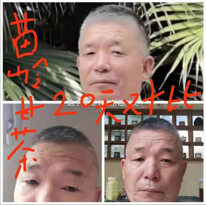 高級(jí)反射蜂療專家范景良