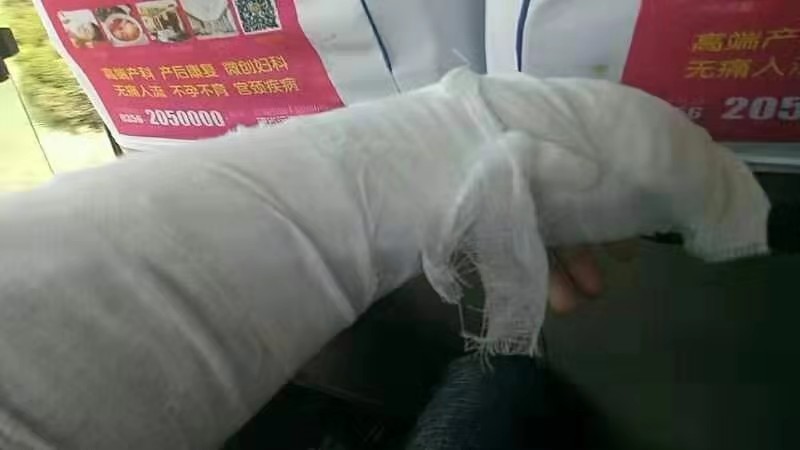 山西三建公司員工受傷無(wú)人問(wèn)津